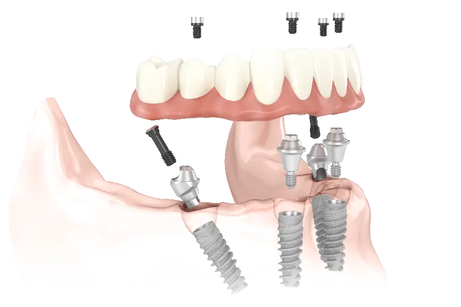 تصویر گرافیکی دور بری شده پی ان جی png دندان کیفیت بالا 