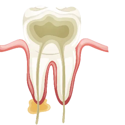 عکس اعصاب داخلی دندان با فرمت png و دوربری شده